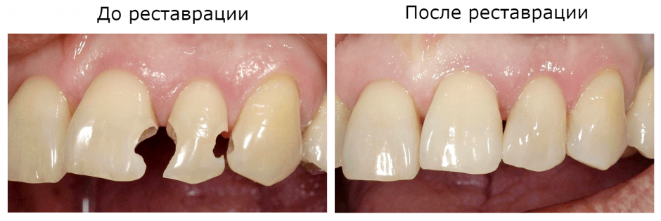 Как изготовить подвязку Как изготовить подвязку